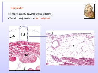 Epicárdio Mesotélio (ep. pavimentoso simples). Tecido conj. frouxo +  tec. adiposo. 