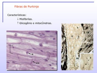 Fibras de Purkinje Características:    Miofibrilas.    Glicogênio e mitocôndrias. 