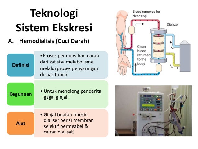 100+ Gambar Alat Cangkok Ginjal Terlihat Keren 100+ Gambar Alat Cangkok Ginjal Terlihat Keren