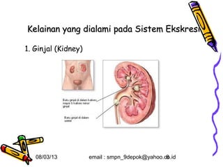 Kelainan yang dialami pada Sistem Ekskresi

1. Ginjal (Kidney)




   08/03/13          email : smpn_9depok@yahoo.co.id
                                                8
 
