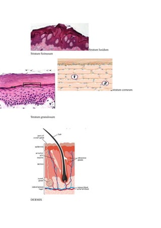 Stratum lusidum
Stratum Soinusum




                                       stratum corneum




Stratum granulosum




DERMIS
 