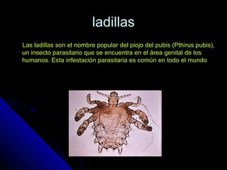 ladillasladillas
Las ladillas son el nombre popular del piojo del pubis (Pthirus pubis),Las ladillas son el nombre popular del piojo del pubis (Pthirus pubis),
un insecto parasitario que se encuentra en el área genital de losun insecto parasitario que se encuentra en el área genital de los
humanos. Esta infestación parasitaria es común en todo el mundohumanos. Esta infestación parasitaria es común en todo el mundo
 