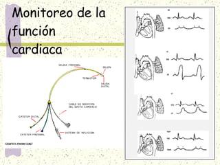 Monitoreo de la función cardiaca 