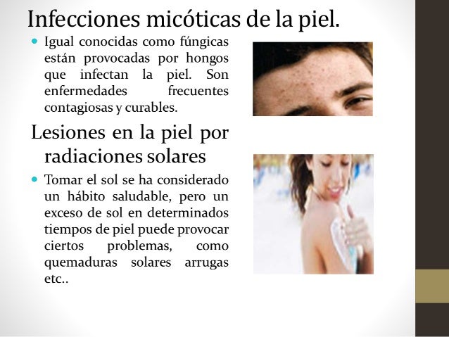 La psoriasis en los pies el tratamiento las revocaciones