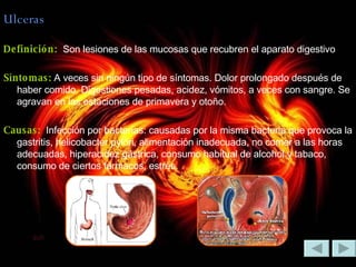 Ulceras Definición:  Son lesiones de las mucosas que recubren el aparato digestivo Síntomas:  A veces sin ningún tipo de síntomas. Dolor prolongado después de haber comido. Digestiones pesadas, acidez, vómitos, a veces con sangre. Se agravan en las estaciones de primavera y otoño. Causas:  Infección por bacterias: causadas por la misma bacteria que provoca la gastritis, helicobacter pylori, alimentación inadecuada, no comer a las horas adecuadas, hiperacidez gástrica, consumo habitual de alcohol y tabaco, consumo de ciertos fármacos, estrés. 