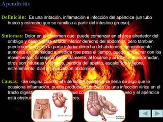 Apendicitis Definición:  Es una irritación, inflamación e infección del apéndice (un tubo hueco y estrecho que se ramifica a partir del intestino grueso). Síntomas:  Dolor en el abdomen que: puede comenzar en el área alrededor del ombligo y desplazarse al lado inferior derecho del abdomen, pero también puede comenzar en la parte inferior derecha del abdomen, generalmente aumenta en intensidad a medida que pasa el tiempo, puede empeorar con los movimientos, al respirar profundamente, al tocarse y al toser o al estornudar, otros son náuseas y vómitos, pérdida del apetito, escalofríos y fiebre, estreñimiento, diarrea, hinchazón abdominal. Causas:  -Se origina cuando el interior del apéndice se llena de algo que le ocasiona inflamación, puede producirse después de una infección vírica en el tracto digestivo, cuando el tubo que conecta el intestino grueso y el apéndice está obstruido o atrapado por heces. 