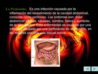 La Peritonitis:   Es una infección causada por la inflamación del revestimiento de la cavidad abdominal, conocida como peritoneo. Los síntomas son: dolor abdominal intenso, nauseas, vómitos, fiebre y aumento de la sensibilidad. Esta enfermedad es causada por una infección causada por una perforación en el intestino, en las mujeres con una vida sexual activa. 