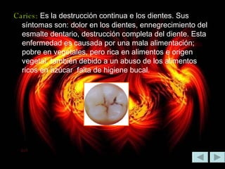Caries:   Es la destrucción continua e los dientes. Sus síntomas son: dolor en los dientes, ennegrecimiento del esmalte dentario, destrucción completa del diente. Esta enfermedad es causada por una mala alimentación; pobre en vegetales, pero rica en alimentos e origen vegetal, también debido a un abuso de los alimentos ricos en azúcar  falta de higiene bucal.  