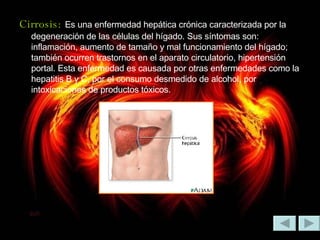 Cirrosis:   Es una enfermedad hepática crónica caracterizada por la degeneración de las células del hígado. Sus síntomas son: inflamación, aumento de tamaño y mal funcionamiento del hígado; también ocurren trastornos en el aparato circulatorio, hipertensión portal. Esta enfermedad es causada por otras enfermedades como la hepatitis B y C, por el consumo desmedido de alcohol, por intoxicaciones de productos tóxicos.  