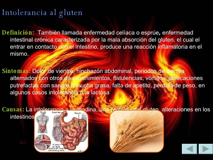 Es nervioso el síndrome muscular sheynogo del departamento de la columna vertebral