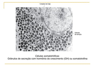 Células somatotróficas  Grânulos de secreção com hormônio do crescimento (GH) ou somatotrofina 