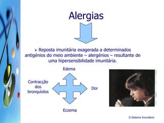 O Sistema Imunitário
Alergias
 Reposta imunitária exagerada a determinados
antigénios do meio ambiente – alergénios – resultante de
uma hipersensibilidade imunitária.
Edema
Contracção
dos
bronquíolos
Eczema
Dor
 
