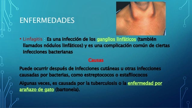 Sistema linfatico