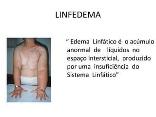 LINFEDEMA
“ Edema Linfático é o acúmulo
anormal de líquidos no
espaço intersticial, produzido
por uma insuficiência do
Sistema Linfático”
 