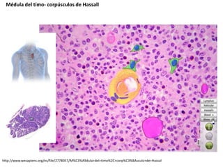 Médula del timo- corpúsculos de Hassall
http://www.wesapiens.org/es/file/2778057/M%C3%A9dula+del+timo%2C+corp%C3%BAsculo+de+Hassal
 