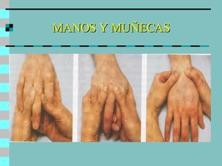 MANOS Y MUÑECAS 