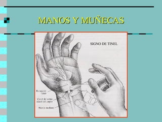 MANOS Y MUÑECAS SIGNO DE TINEL 