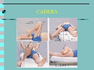 CADERA 