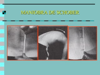 MANIOBRA DE SCHOBER 