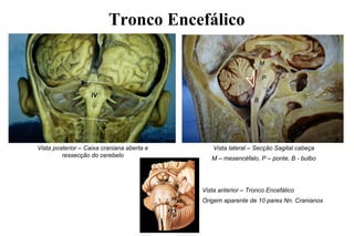 Tronco Encefálico
Vista posterior – Caixa craniana aberta e
ressecção do cerebelo
Vista lateral – Secção Sagital cabeça
M – mesencéfalo, P – ponte, B - bulbo
M
P
B
IV
Vista anterior – Tronco Encefálico
Origem aparente de 10 pares Nn. Cranianos
III
IV
V
VI
VII
VIII
IX
X
XI
XII
 