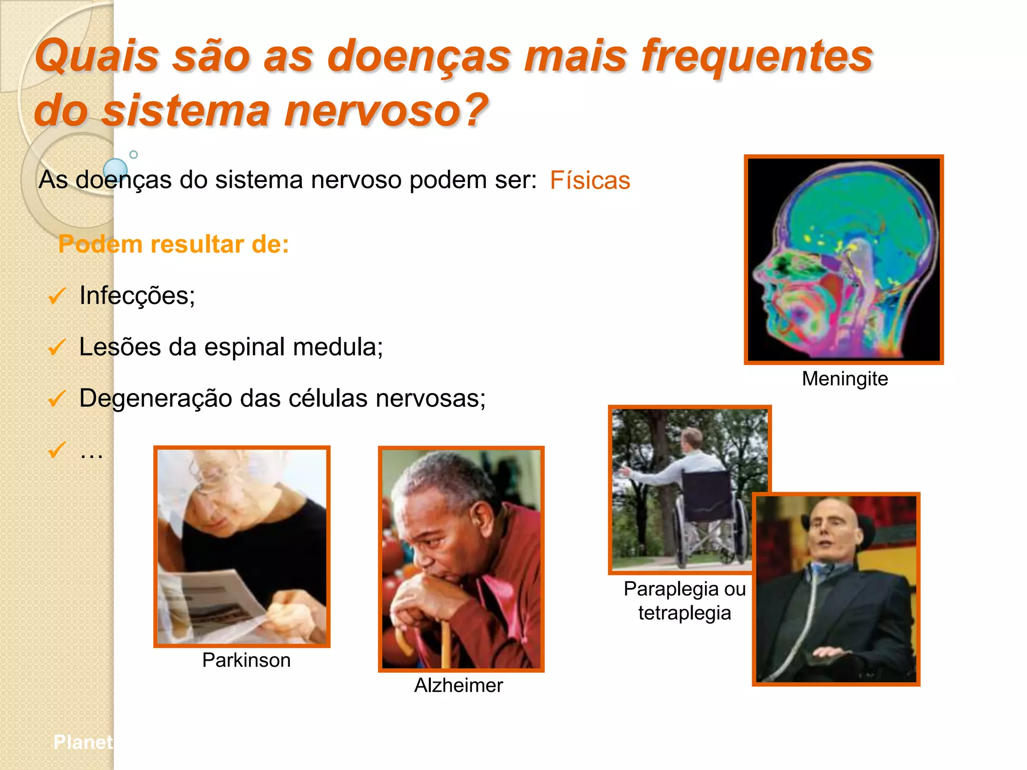 Quais são as doenças mais frequentes
do sistema nervoso?
As doenças do sistema nervoso podem ser: Físicas

 Podem resultar de:

 Infecções;
 Lesões da espinal medula;
                                                               Meningite
 Degeneração das células nervosas;

 …




                                               Paraplegia ou
                                                tetraplegia

                Parkinson
                              Alzheimer

 Planeta Terra — 9.º ano
 