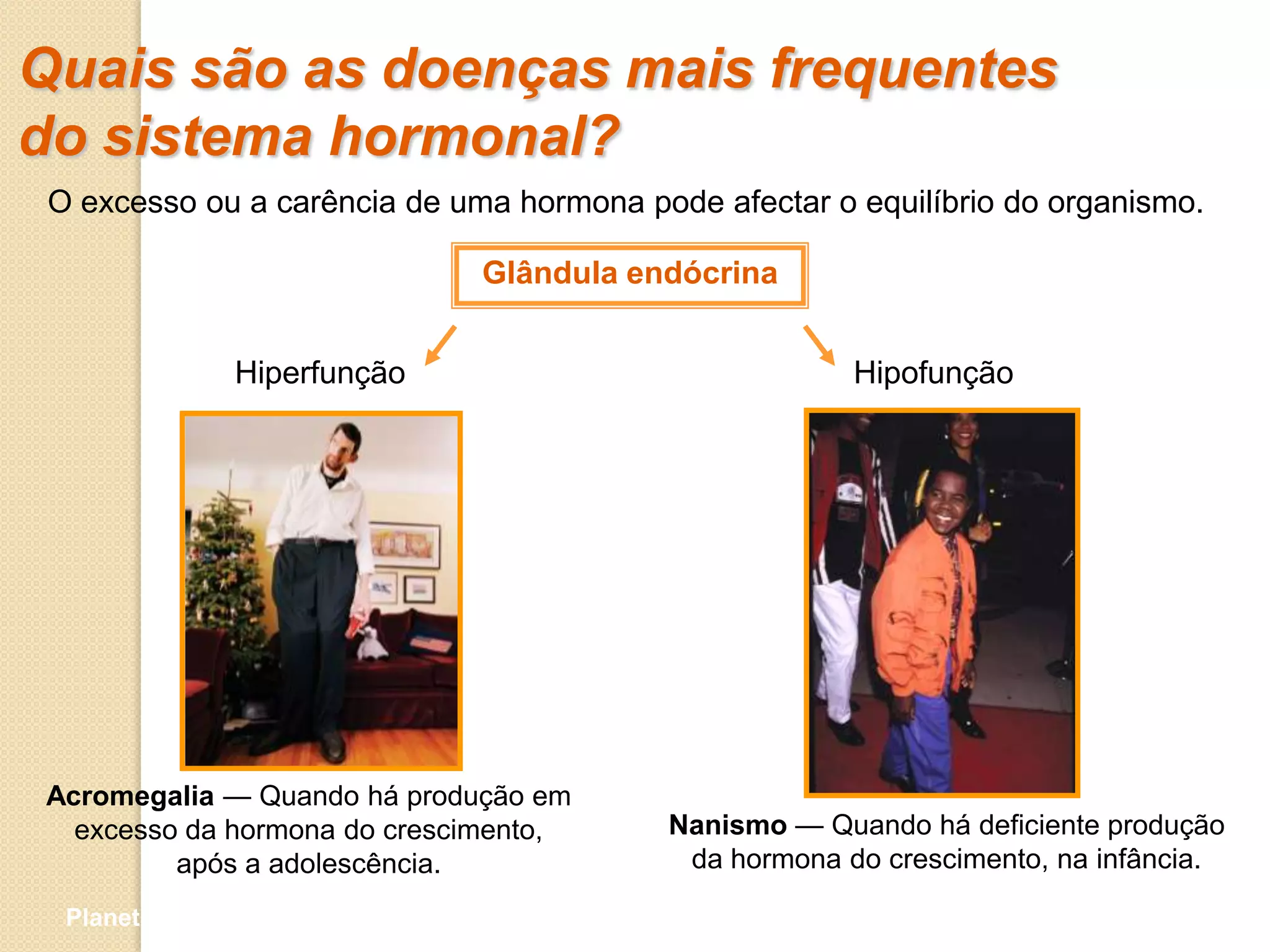 Quais são as doenças mais frequentes
do sistema hormonal?
 O excesso ou a carência de uma hormona pode afectar o equilíbrio do organismo.

                              Glândula endócrina


                Hiperfunção                            Hipofunção




Acromegalia — Quando há produção em
  excesso da hormona do crescimento,      Nanismo — Quando há deficiente produção
         após a adolescência.              da hormona do crescimento, na infância.

  Planeta Terra — 9.º ano
 