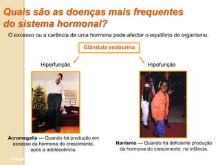 Quais são as doenças mais frequentes
do sistema hormonal?
 O excesso ou a carência de uma hormona pode afectar o equilíbrio do organismo.

                              Glândula endócrina


                Hiperfunção                            Hipofunção




Acromegalia — Quando há produção em
  excesso da hormona do crescimento,      Nanismo — Quando há deficiente produção
         após a adolescência.              da hormona do crescimento, na infância.

  Planeta Terra — 9.º ano
 