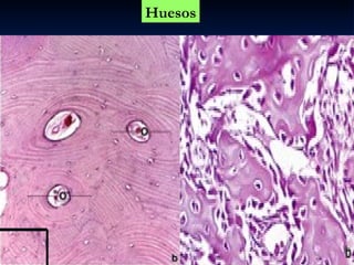 Huesos
 