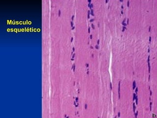 Músculo
esquelético
 