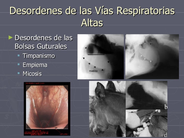 Sistema Respiratorio