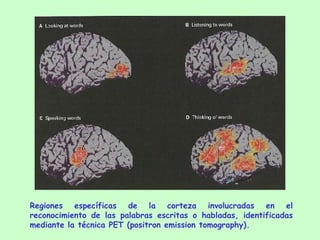 Regiones específicas de la corteza involucradas en el reconocimiento de las palabras escritas o habladas, identificadas mediante la técnica PET (positron emission tomography).  