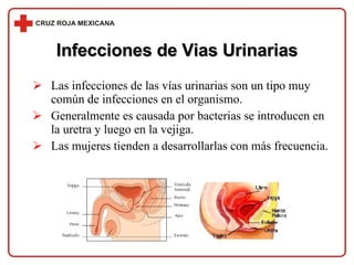 Infecciones de Vias Urinarias Las infecciones de las vías urinarias son un tipo muy común de infecciones en el organismo. Generalmente es causada por bacterias se introducen en la uretra y luego en la vejiga. Las mujeres tienden a desarrollarlas con más frecuencia. 