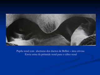 Papila renal com  aberturas dos ductos de Bellini – área crivosa  Envia urina da pirâmide renal para o cálice renal 