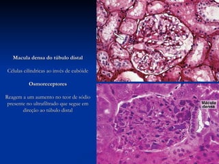 Macula densa do túbulo distal Células cilíndricas ao invés de cubóide Osmoreceptores Reagem a um aumento no teor de sódio presente no ultrafiltrado que segue em direção ao túbulo distal 