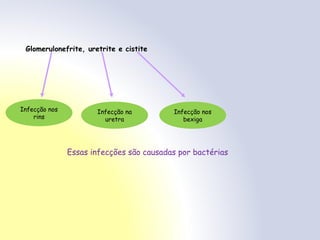 Glomerulonefrite, uretrite e cistite
Infecção nos
rins
Infecção na
uretra
Infecção nos
bexiga
Essas infecções são causadas por bactérias
 