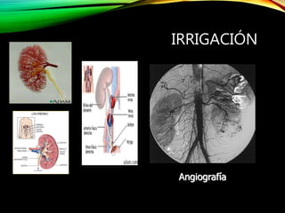 IRRIGACIÓN
Angiografía
 