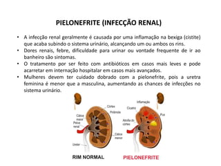 PIELONEFRITE (INFECÇÃO RENAL)
• A infecção renal geralmente é causada por uma inflamação na bexiga (cistite)
que acaba subindo o sistema urinário, alcançando um ou ambos os rins.
• Dores renais, febre, dificuldade para urinar ou vontade frequente de ir ao
banheiro são sintomas.
• O tratamento por ser feito com antibióticos em casos mais leves e pode
acarretar em internação hospitalar em casos mais avançados.
• Mulheres devem ter cuidado dobrado com a pielonefrite, pois a uretra
feminina é menor que a masculina, aumentando as chances de infecções no
sistema urinário.
 