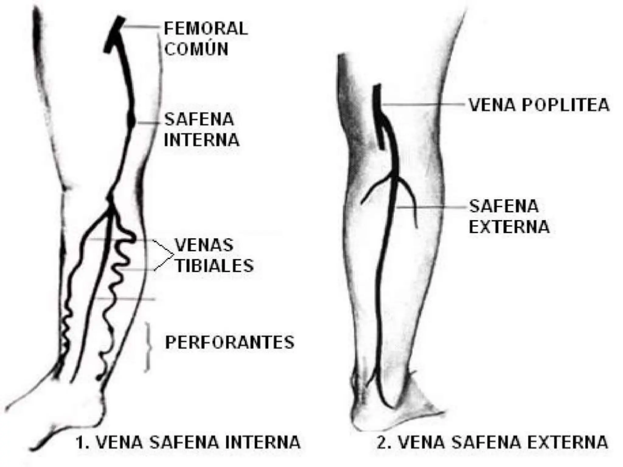 Vascular Rarea sistema vascular periferico, arterias y venas | PPT
