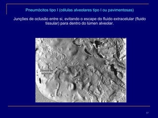 Pneumócitos tipo I (células alveolares tipo I ou pavimentosas) Junções de oclusão entre si, evitando o escape do fluido extracelular (fluido tissular) para dentro do lúmen alveolar. 