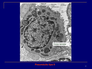 Corpo lamelar Pneumócito tipo II 