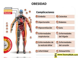 OBESIDAD
 