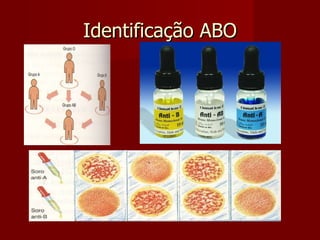 Identificação ABO 