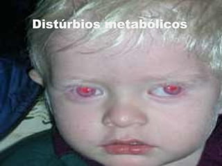 Distúrbios metabólicos
 