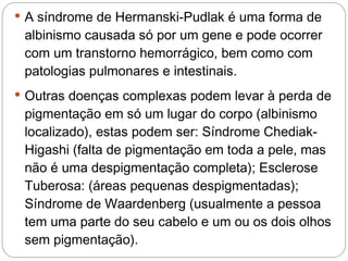  A síndrome de Hermanski-Pudlak é uma forma de
 albinismo causada só por um gene e pode ocorrer
 com um transtorno hemorrágico, bem como com
 patologias pulmonares e intestinais.
 Outras doenças complexas podem levar à perda de
 pigmentação em só um lugar do corpo (albinismo
 localizado), estas podem ser: Síndrome Chediak-
 Higashi (falta de pigmentação em toda a pele, mas
 não é uma despigmentação completa); Esclerose
 Tuberosa: (áreas pequenas despigmentadas);
 Síndrome de Waardenberg (usualmente a pessoa
 tem uma parte do seu cabelo e um ou os dois olhos
 sem pigmentação).
 