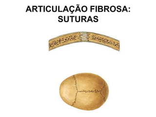 ARTICULAÇÃO FIBROSA:
SUTURAS