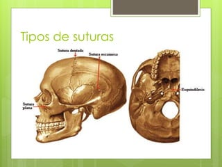 Tipos de suturas
 