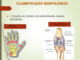  1) Quanto ao número de extremidades ósseas
articulares
SIMPLES
COMPOSTA
 