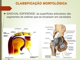  SINOVIAL ESFERÓIDE: as superfícies articulares são
segmentos de esferas que se encaixam em cavidades
 