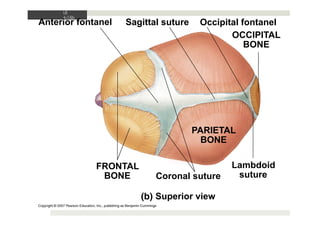LE
6-15b
FRONTAL
BONE Coronal suture
Superior view
PARIETAL
BONE
Lambdoid
suture
OCCIPITAL
BONE
Occipital fontanel
Sagitta...