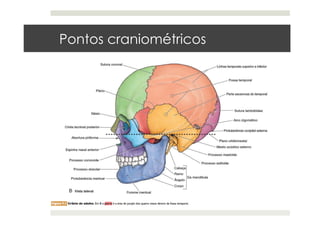 Pontos craniométricos
 